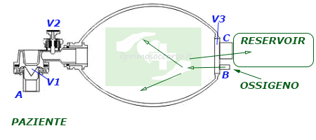 L'ossigeno fluisce dalla bombola nel corpo centrale dell'ambu e gonfia il reservoir