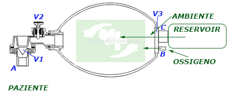 L'ambu si riempie nuovamente. Qual'ora mancasse l'apporto del reservoir, attraverso la valvola V3 può entrare aria ambiente